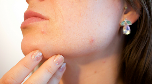 How sleep, diet, stress and your environment can help or harm your skin resulting in acne breakouts, wrinkles, and inflammation.